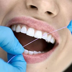 Dental Cleanings & Exams